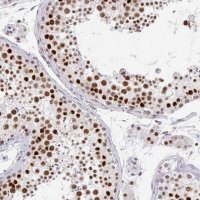 Anti-GTF2H1 antibody produced in rabbit 