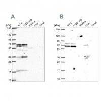 Anti-GTF3C5 antibody produced in rabbit 