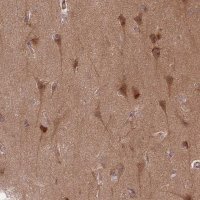 Anti-GUK1 antibody produced in rabbit 