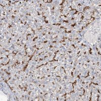 Anti-GUSB antibody produced in rabbit