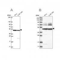 Anti-HADHB antibody produced in rabbit