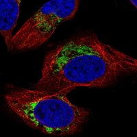 Anti-HADHB antibody produced in rabbit