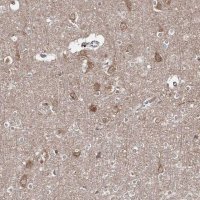 Anti-HARS antibody produced in rabbit 