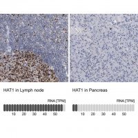 Anti-HAT1 antibody produced in rabbit 