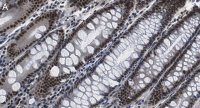 Anti-HCF-1 Antibody, clone 1B17 ZooMAb� Rabbit Monoclonal 
