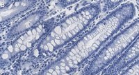 Anti-HCF-1 Antibody, clone 1B17 ZooMAb® Rabbit Monoclonal