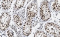 Anti-HDAC2 Antibody, clone 1E22 ZooMAb� Rabbit Monoclonal 