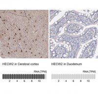 Anti-HECW2 antibody produced in rabbit 