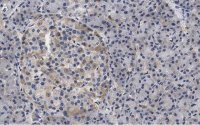 Anti-Helicase MOV-10 Antibody, clone 3B8 ZooMAb� Rabbit Monoclonal 