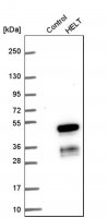 Anti-HELT antibody produced in rabbit HPA036189-100UL