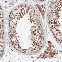 Anti-HESX1 antibody produced in rabbit 