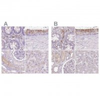 Anti-HEXB antibody produced in rabbit 