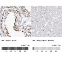 Anti-HEXIM2 antibody produced in rabbit 