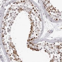 Anti-HEXIM2 antibody produced in rabbit 