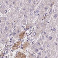 Anti-HGFAC antibody produced in rabbit 