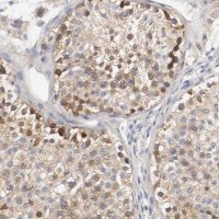 Anti-HGS antibody produced in rabbit 