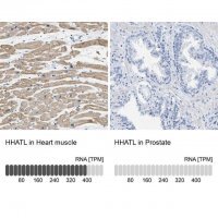 Anti-HHATL antibody produced in rabbit 