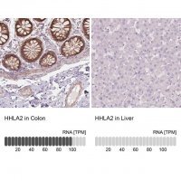 Anti-HHLA2 antibody produced in rabbit 