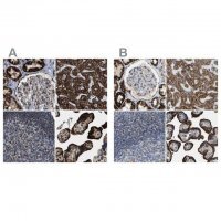 Anti-HIBADH antibody produced in rabbit HPA021002-100UL