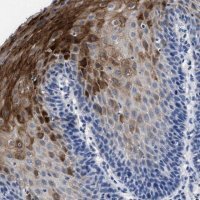 Anti-HID1 antibody produced in rabbit