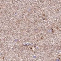 Anti-HIP1R antibody produced in rabbit 