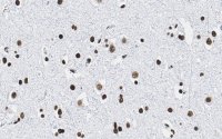 Anti-Histone H2B Antibody, clone 4O11 ZooMAb� Rabbit Monoclonal 