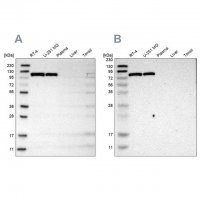 Anti-HK1 antibody produced in rabbit 