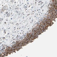Anti-HK1 antibody produced in rabbit 