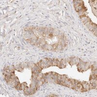 Anti-HK2 antibody produced in rabbit 