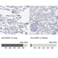 Anti-HLA-DQA1 antibody produced in rabbit 