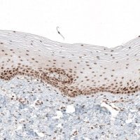 Anti-HLTF antibody produced in rabbit