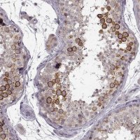 Anti-HMMR antibody produced in rabbit
