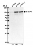 Anti-HNRNPU antibody produced in rabbit HPA058707-100UL