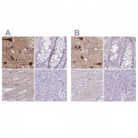 Anti-HOMER1 antibody produced in rabbit 