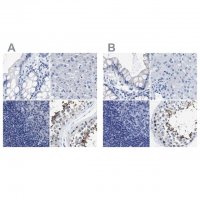 Anti-HOOK1 antibody produced in rabbit HPA018820-100UL