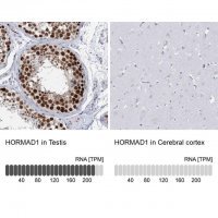 Anti-HORMAD1 antibody produced in rabbit