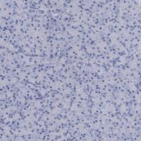 Anti-HORMAD1 antibody produced in rabbit