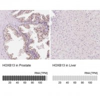 Anti-HOXB13 antibody produced in rabbit