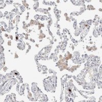 Anti-HPGDS antibody produced in rabbit 