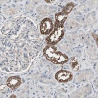 Anti-HPRT1 antibody produced in rabbit 