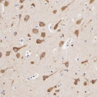Anti-HS3ST1 antibody produced in rabbit HPA002237-100UL