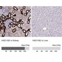 Anti-HSD11B2 antibody produced in rabbit