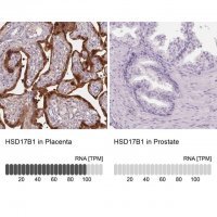Anti-HSD17B1 antibody produced in rabbit 