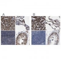 Anti-HSD17B4 antibody produced in rabbit 