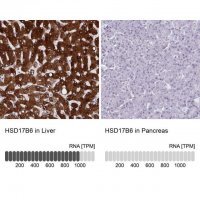 Anti-HSD17B6 antibody produced in rabbit 