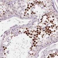 Anti-HSF5 antibody produced in rabbit 