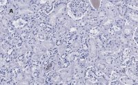Anti-HSP60 Antibody, clone 1N3, ZooMAb� Rabbit Monoclonal 
