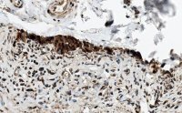 Anti-HSP70 Antibody, clone 4E12 ZooMAb� Rabbit Monoclonal 