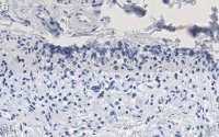 Anti-HSP70 Antibody, clone 4E12 ZooMAb� Rabbit Monoclonal 