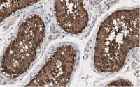 Anti-HSP90 alpha Antibody, clone 4M13 ZooMAb� Rabbit Monoclonal 